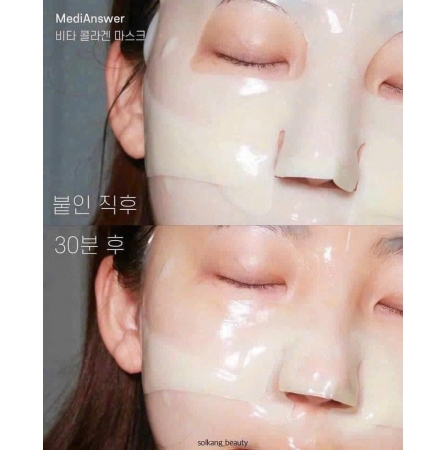 Mặt nạ thạch Collagen MediAnswer