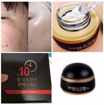 Set kem đặc trị Nám DongSung bản Vip